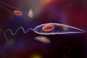 Leishmaniasis